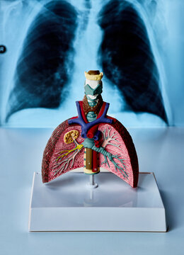 Human lung anatomy model displayed with chest X-ray in medical office for respiratory examination, pulmonary diagnosis and clinical consultation