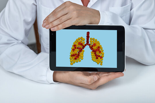 Medical doctor presenting an artistic floral illustration of healthy human lungs on a tablet screen during a pulmonary health consultation