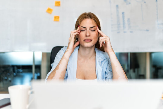 Stressed businesswoman with headache holding temples. Tired female worker sitting at office desk with laptop experiencing burnout and pressure. Overworked professional concept.