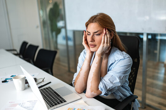 Exhausted businesswoman with headache holding head. Frustrated female employee sitting at office desk with laptop facing burnout, stress and overwork. Workplace pressure concept.