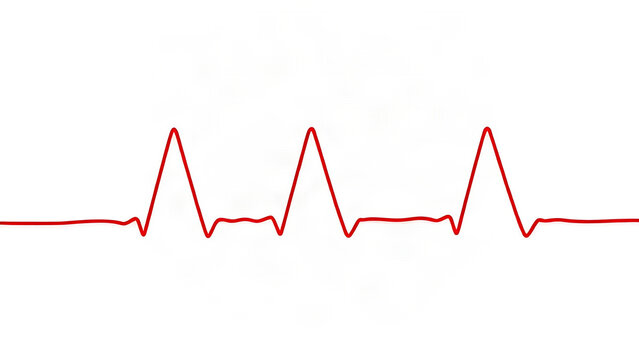 Red ECG line pattern transitioning from flat to sharp peaks on white background, medical graphic.