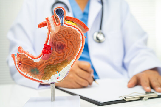 Stomach disease, doctor holding anatomy model for study diagnosis and treatment in hospital.
