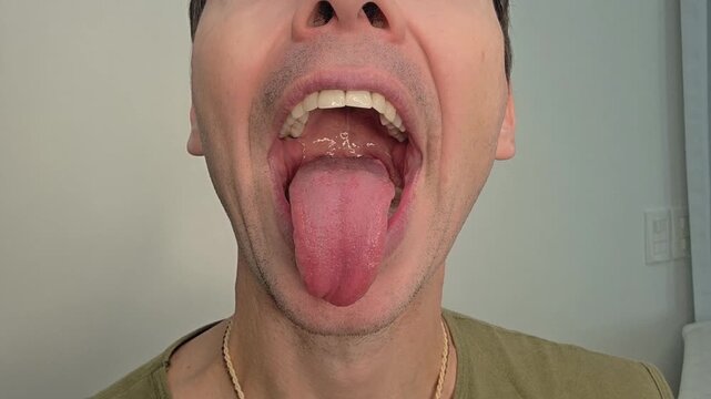 homem c&ocirc;migo faz exercicios fonoaudiologo faciais para produ&ccedil;&atilde;o da voz 