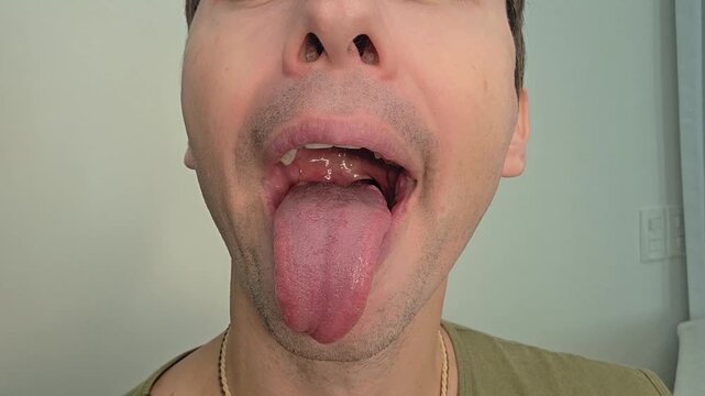 homem c&ocirc;migo faz exercicios fonoaudiologo faciais para produ&ccedil;&atilde;o da voz 