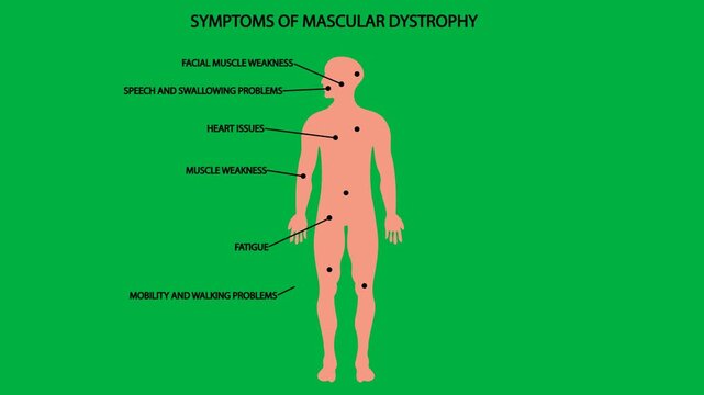 Medical vector animation displaying a human silhouette with clinical symptoms highlighting Becker muscular dystrophy, Duchenne muscular dystrophy, myotonic dystrophy, spinal muscular atrophy
