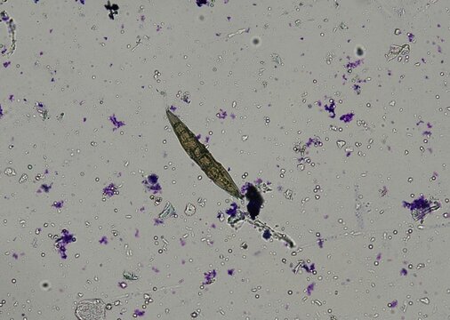 soil microorganisms under a microscope including amoeba, flagellates, nematodes, fungi, bacteria	