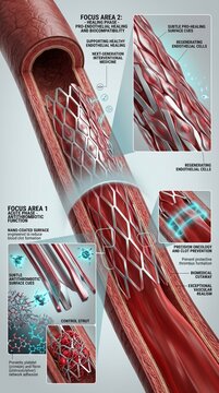 Nanocoated Coronary Stent Supporting Endothelial Healing and Thrombosis Prevention