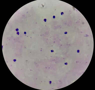 microscope image of plasmodium falciparum malaria parasite 