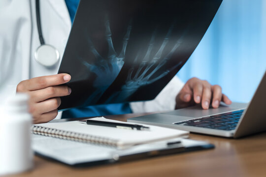 Doctor examining x-ray film and taking notes on document while working on laptop computer in clinical office, medical diagnosis concept.