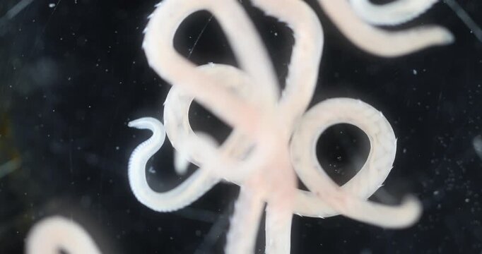 Scientific collection of freshwater trematode parasites, including Clinostomum spp., Postorchigenes sp., and Thapariella sp. These parasitic flatworms have complex life cycles involving multiple hosts