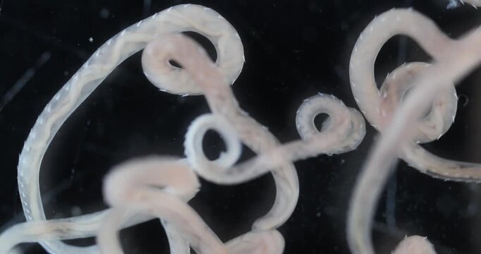 Scientific collection of freshwater trematode parasites, including Clinostomum spp., Postorchigenes sp., and Thapariella sp. These parasitic flatworms have complex life cycles involving multiple hosts