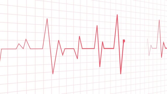 Heartbeat line electrocardiogram pulse pattern medical and health concept animation