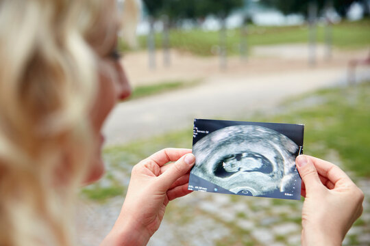 Pregnant woman looking at ultrasound image outdoors