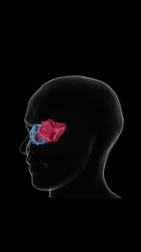 Graves' disease progression in the eyes refers to changes associated with thyroid eye disease, including swelling of tissues around the eyes, eyelid retraction, eye prominence in UHD