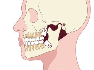 Impacted Wisdom Teeth Anatomical Illustration in Human Jaw © Tezar