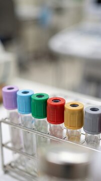 Medical Vacuum Blood Collection Tubes in a Lab Rack