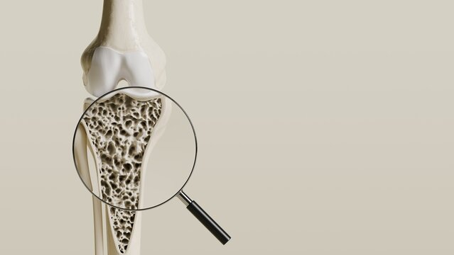 Magnifying glass showing osteoporosis bone structure inside knee joint 3d rendering