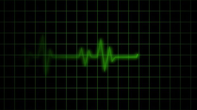Abstract green cardiograph recording with heartbeat flatline motion in 4K video quality, Heartbeat flatline green neon with Textured Effect on Black Background. glowing ecg heartbeat line 