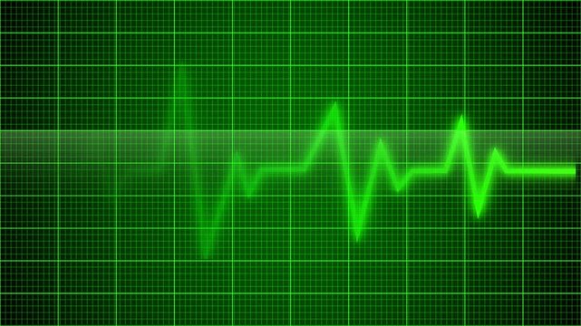 Heartbeat green flatline 4k animation. Heartbeat green flatline 4k animation. glowing ecg heartbeat line on medical monitor grid animation. Heartbeat flatline green neon with Textured Effect. 