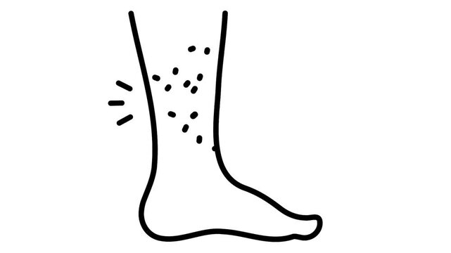 human lower leg with visible hair growth on the shin area animation, calf plastic surgery animated video, plastic surgery procedure motion graphics