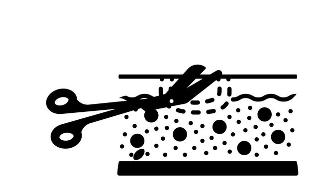 scalpel making cut animation, minor surgical procedure animated video, skin incision motion graphics