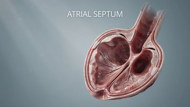Medical visualization showing human heart anatomy focusing on atrial septum