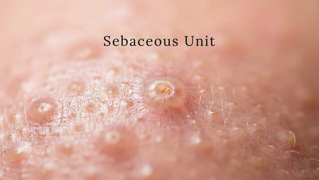 Microscopic view of human skin showing a sebaceous unit
