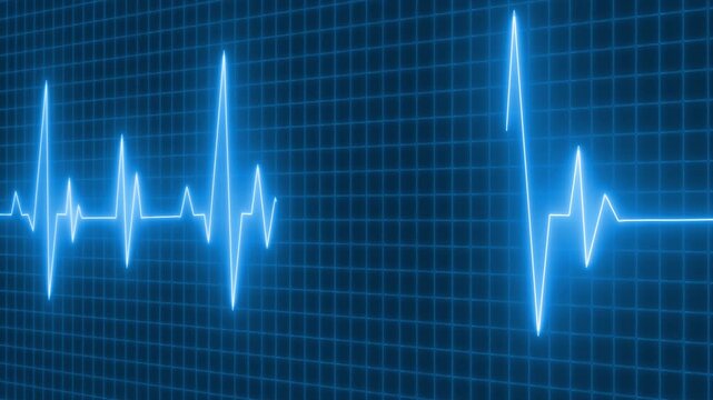 Glowing ecg heartbeat waveform on grid background animation, Electrocardiogram waveform glowing heartbeat pulse lines across screen