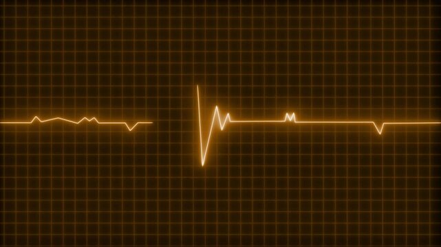 Glowing neon ecg heartbeat waveform on grid background animation