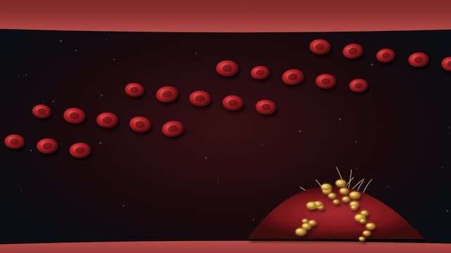 Detailed cinematic 3D medical visualization showing platelet aggregation, fibrin formation and thrombus growth inside a blood vessel while red blood cells flow around the developing obstruction.