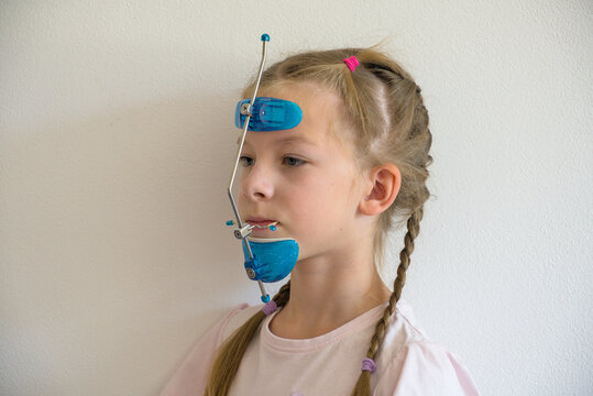 Young girl wearing orthodontic extraoral face mask headgear for bite correction and jaw realignment, portrait on white background