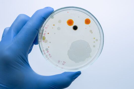A petri dish in a scientist's hand with two red colonies of bacteria resistant to human chemical pollution.
