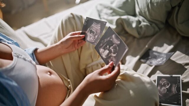Sonogram photos pregnant woman hands close up. Expectant mother ultrasound bed.