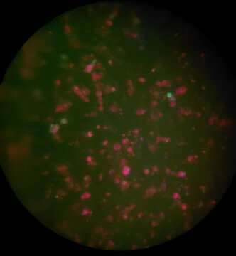 Fluorescence microscopy visualization of stained cells with red fluorescent marker