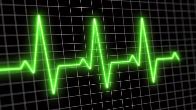 Green EKG heart rhythm wave on dark grid background with subtle motion for medical concept
