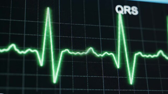 Medical electrocardiogram waveform displaying healthy heart rhythm on a dark digital monitor with green glowing lines