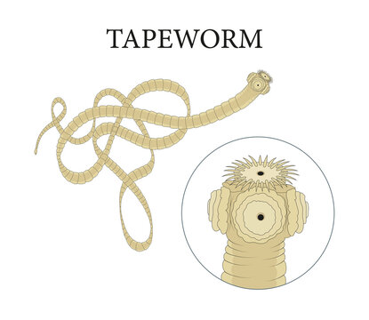 The tapeworm and its scolex