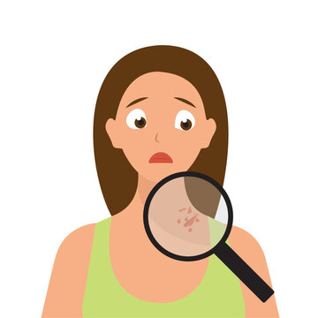 Worried Woman Checking Shingles Rash on Neck with Magnifying Glass Vector.

