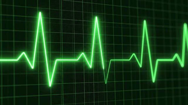 Vital heart rhythm pulsating on a green digital monitor with grid background during a medical emergency