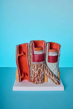 Anatomical model of human blood vessels. Treatment of atherosclerosis and hypertension