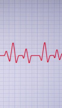 EKG tracing on a medical chart showing normal heartbeat rhythm, doctor's office, technology