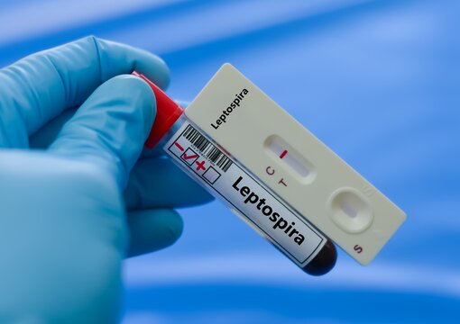 Blood sample of patient negative result for leptospira.