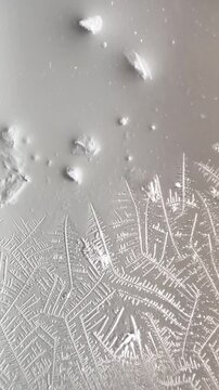 Human saliva dries under microscope, forming crystalline patterns as moisture evaporates. Saliva crystallization is studied in microscopy for biological research and potential health assessment. 