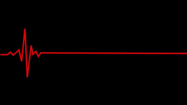 glow rad Animated Heartbeat Rhythm Oscillating line animation