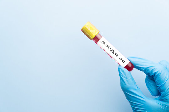 Doctor holding a test blood sample tube with BRCA1 and BRCA2 test, gene marker for breast cancer.
