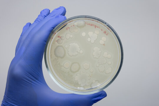 Bacterial growths on a nutrient medium in a petri dish held by a scientist on a white background.