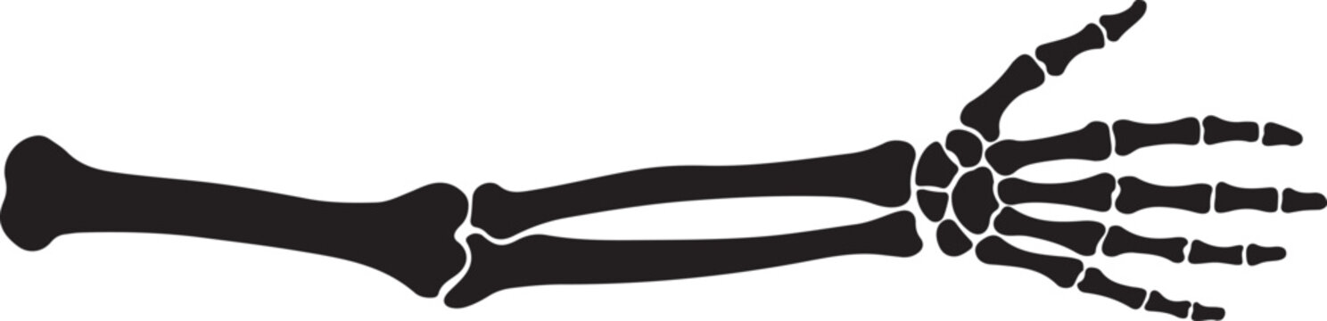 Detailed black silhouette of a human arm and hand skeleton, showing bones of the forearm, wrist, and fingers, on white background