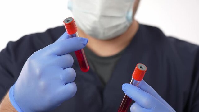 The doctor examines test tubes with blood tests. Blood test in a test tube in a doctor's hands.