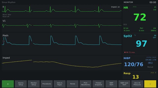 Animated EKG heart rate monitor displaying a normal sinus rhythm