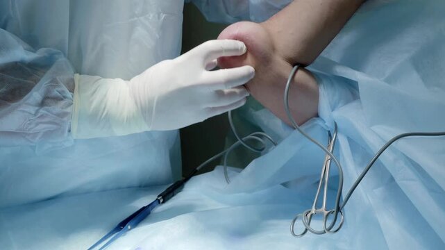 Russia Tomsk 05.07.2025: Operating room staff readying injured foot joint, Healthcare professionals meticulously setting up for surgical repair, Surgeon and team carefully organize tools